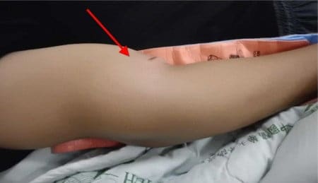 elbow-fx (1)