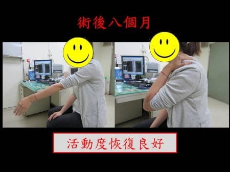 elbow-fx2- (5)