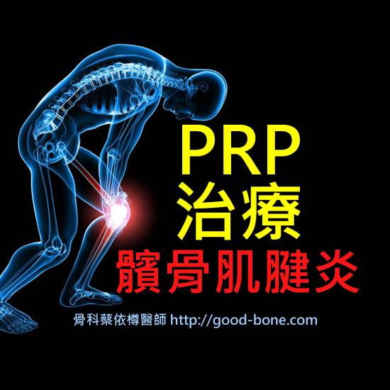 PRP 治療 髕骨肌腱炎 MB 骨科蔡依樽醫師 https://www.good-bone.com/