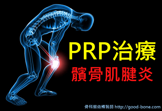 prp-patellar-tendinitis-01