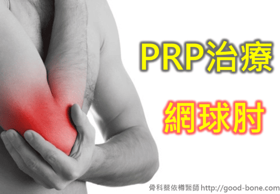 prp-tennis-elbow-01