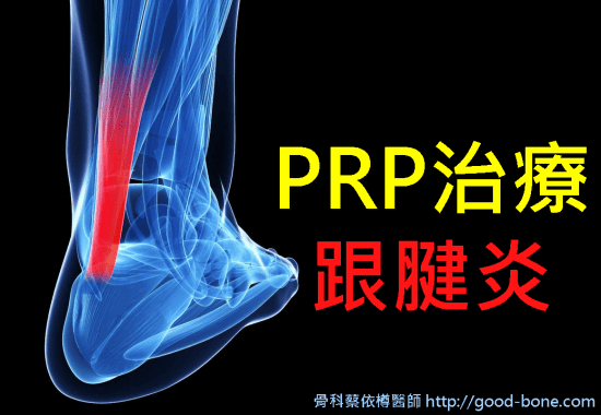 Homepage-prp-achilles-tendinitis-01