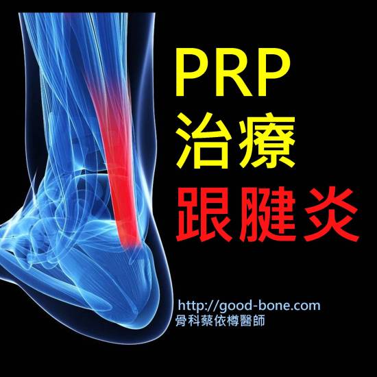 PRP 治療 跟腱炎 骨科蔡依樽醫師 https://www.good-bone.com/