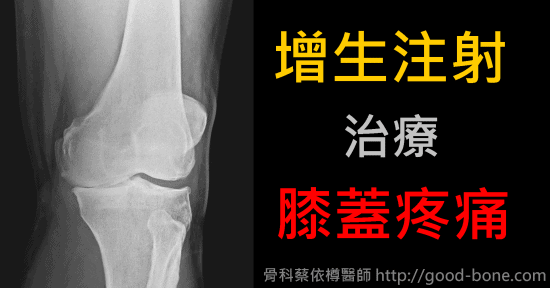 HomePage-FB-case002-oa-knee