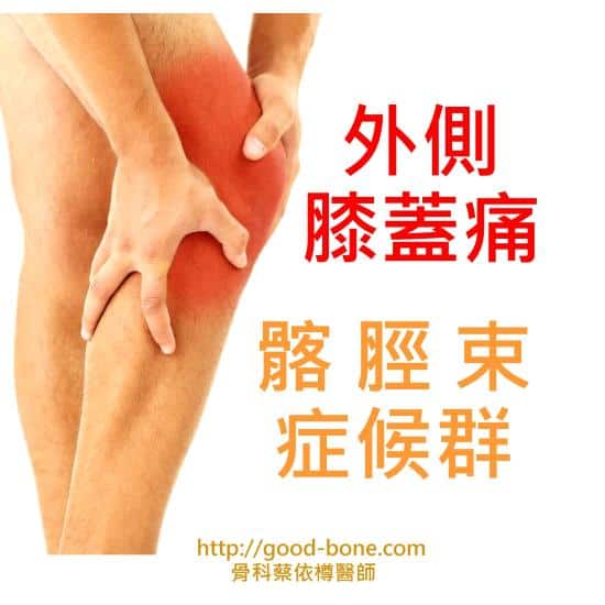 外側膝蓋痛 髂脛束症候群｜台中骨科蔡依樽醫師https://www.good-bone.com