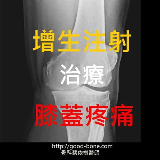 增生注射治療膝蓋疼痛｜台中骨科蔡依樽醫師https://www.good-bone.com