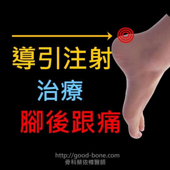 超音波導引注射治療腳後跟痛|台中骨科蔡依樽醫師https://www.good-bone.com