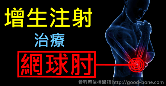 增生注射治療網球肘|台中骨科蔡依樽醫師https://good-bone.com