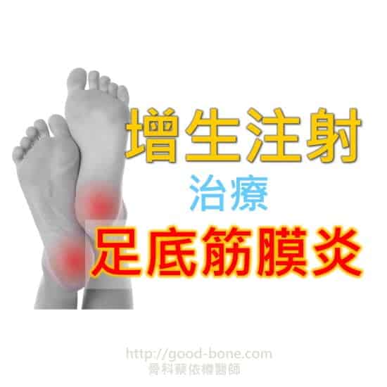 增生注射治療足底筋膜炎|台中骨科蔡依樽醫師https://www.good-bone.com