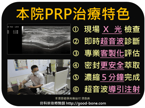 ACP/PRP自體血小板生長因子；超音波導引PRP 注射治療雙膝蓋退化疼痛關節炎｜疼痛注射專家、超音波導引PRP增生治療、專業骨科推薦｜台中骨科蔡依樽醫師https://good-bone.com