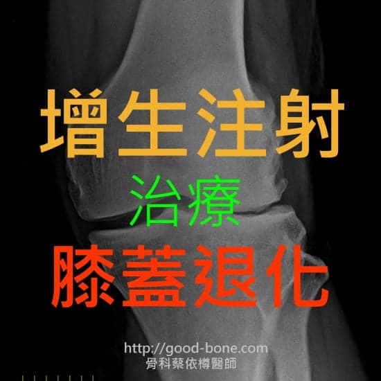 增生注射治療希蓋退化|台中骨科蔡依樽醫師https://www.good-bone.com