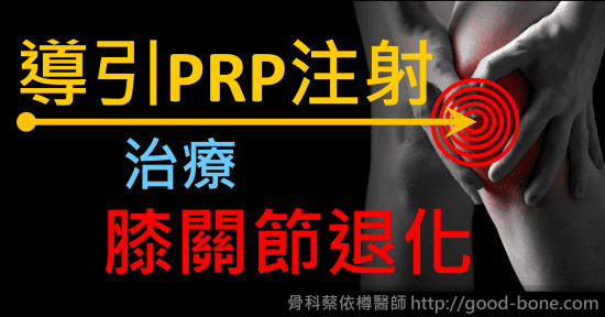 導引PRP注射治療膝關節退化｜專業骨科推薦｜台中骨科蔡依樽醫師https://good-bone.com