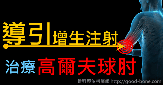 超音波導引增生注射治療慢性高爾夫球肘｜專業骨科推薦｜台中骨科蔡依樽醫師https://good-bone.com