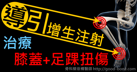 超音波導引增生注射治療膝蓋足踝扭傷。專業骨科推薦｜台中骨科蔡依樽醫師https://good-bone.com