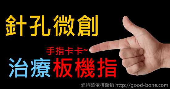 針孔微創治療手指卡卡的板機指｜專業骨科推薦｜台中骨科蔡依樽醫師https://good-bone.com