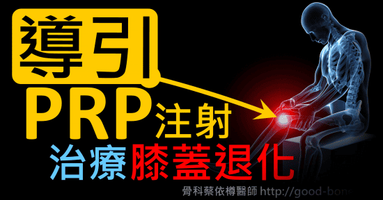 超音波導引PRP 注射治療雙膝蓋退化疼痛關節炎｜疼痛注射專家、超音波導引PRP增生治療、專業骨科推薦｜台中骨科蔡依樽醫師https://good-bone.com