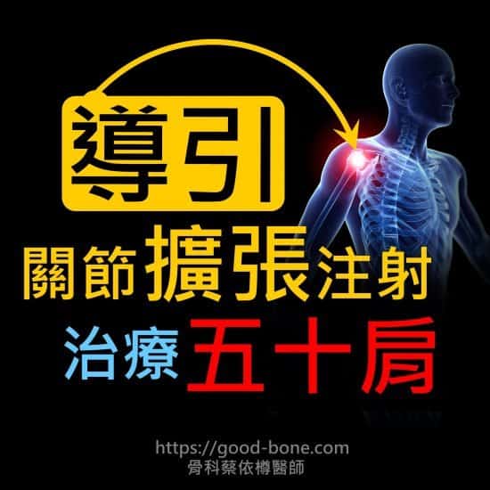 超音波導引關節擴張注射治療五十肩肩膀疼痛沾黏｜專業骨科推薦｜台中骨科蔡依樽醫師https://www.good-bone.com