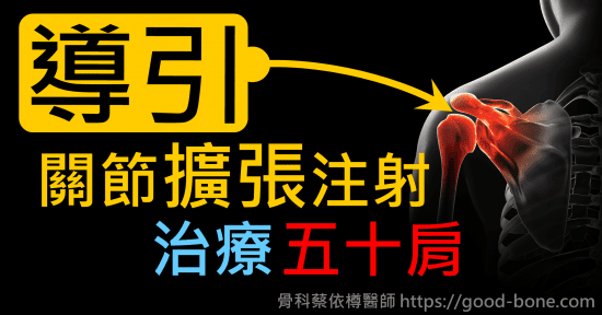 超音波導引關節擴張注射治療五十肩肩膀疼痛沾黏｜專業骨科推薦｜台中骨科蔡依樽醫師https://good-bone.com