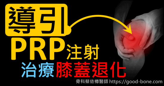 超音波導引PRP 注射治療雙膝蓋退化疼痛關節炎｜疼痛注射專家、超音波導引PRP增生治療、專業骨科推薦｜台中骨科蔡依樽醫師https://good-bone.com