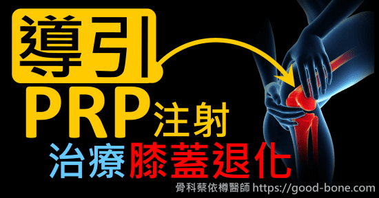 超音波導引PRP 注射治療雙膝蓋退化疼痛關節炎｜疼痛注射專家、超音波導引PRP增生治療、專業骨科推薦｜台中骨科蔡依樽醫師https://good-bone.com