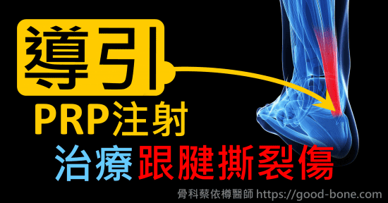 超音波導引PRP 注射治療跟腱撕裂傷｜疼痛注射專家、超音波導引PRP增生治療、專業骨科推薦｜台中骨科蔡依樽醫師https://good-bone.com