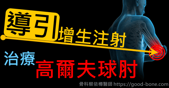 超音波導引增生注射治療高爾夫球肘｜疼痛注射專家、超音波導引PRP增生治療、專業骨科推薦｜台中骨科蔡依樽醫師https://good-bone.com