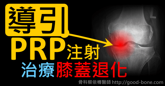 超音波導引PRP 注射治療膝蓋退化疼痛關節炎｜疼痛注射專家、超音波導引PRP增生治療、專業骨科推薦｜台中骨科蔡依樽醫師https://good-bone.com