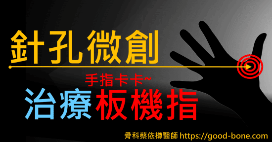 針孔微創治療手指卡卡板機指｜疼痛注射專家、超音波導引PRP增生治療、專業骨科推薦｜台中骨科蔡依樽醫師https://good-bone.com