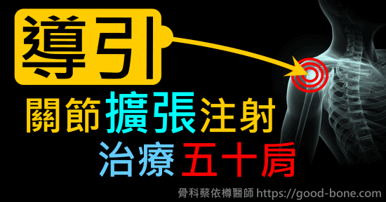 超音波導引關節擴張注射治療五十肩肩膀疼痛沾黏｜專業骨科推薦｜台中骨科蔡依樽醫師https://good-bone.com