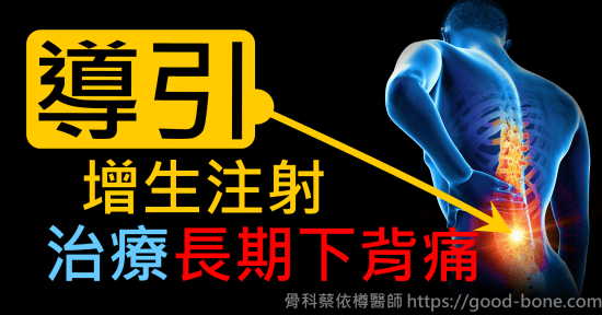 超音波導引葡萄糖增生注射治療長期慢性下背痛｜疼痛注射專家、超音波導引PRP增生治療、葡萄糖增生治療、專業骨科推薦｜台中骨科蔡依樽醫師https://good-bone.com