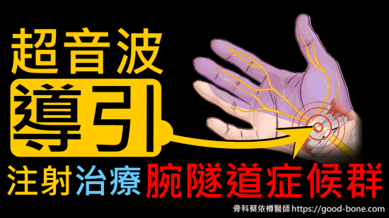 carpal tunnel syndrome, 腕隧道症候群，正中神經壓迫，超音波導引正中神經解套注射，治療前後比較，費倫測試、tinel sign, phalen test, median nerve compression neuropathy, 疼痛注射專家、超音波導引PRP增生治療、五十肩關節擴張注射治療、扳機指微創治療手術、網球肘、高爾夫球肘、媽媽手、膝蓋退化、專業骨科推薦｜台中骨科蔡依樽醫師https://good-bone.com